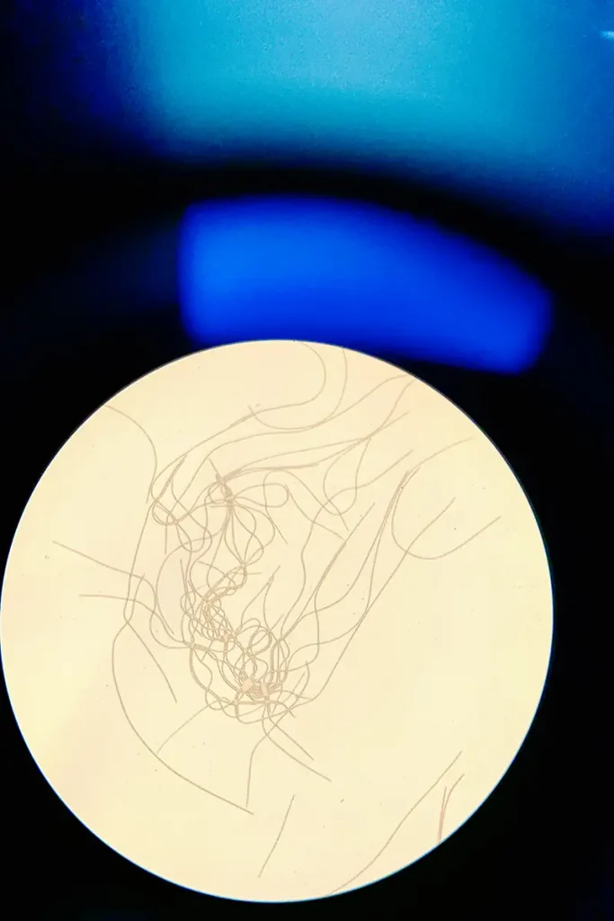 A microscopic image of what the Mead's Quarry Lake water samples look like at 100x magnification. 